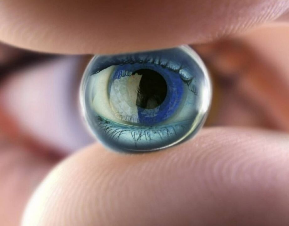 Orthokeratology night contact lenses will stop the progression of vision loss